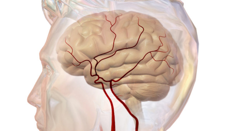 Cerebrovascular_System