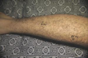 07_stomach_40_stomach_36